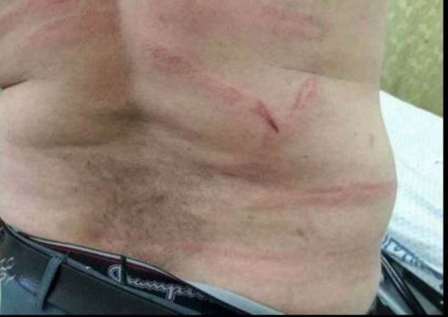 صور.. تفاصيل الاعتداء على مدرس بالضرب المبرح جنوب قطاع غزة