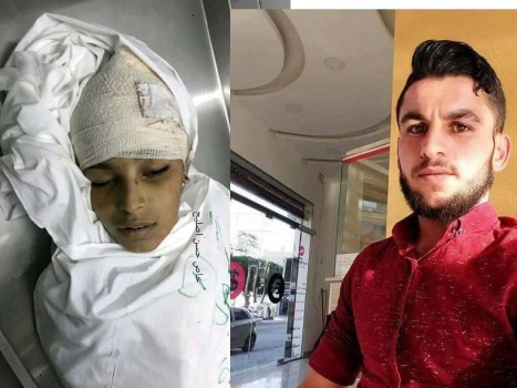 شهيدان برصاص الاحتلال في غزة واصابة العشرات