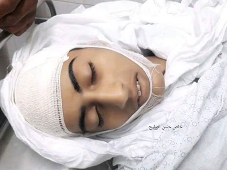 استشهاد فتى برصاص الاحتلال في رفح