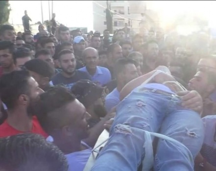 اصابة شاب سقط عن علو في بيت امر