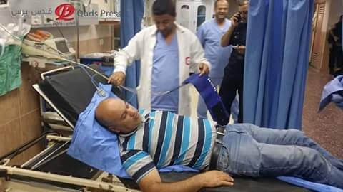 اصابة صحفي بعيار معدني في كفر قدوم