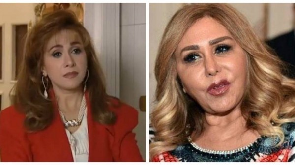 مها المصري بشكل جديد بعد معاناتها مع عمليات التجميل