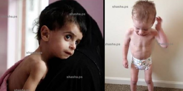 فيديو.. إن كان طفلك هزيلاً وقصيراً فأنتِ السبب لفعلك هذا الشيء!