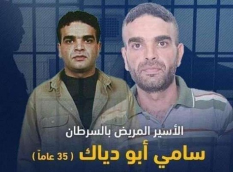 جنين:الأسير سامي أبو دياك يتهدده الموت ونقله لمستشفى "هار هاسوفي"