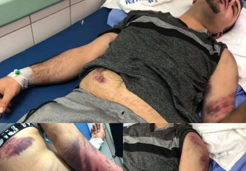 القبض على سبعة اشخاص في رام الله  لاعتدائهم على محامي بالعيزريةوبحوزتهم كمبيالات بمليون دولار