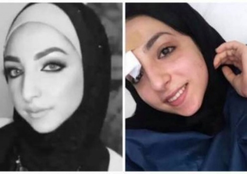 العدل': استقالة 'الأطباء' ليس مرتبطا بقضية إسراء