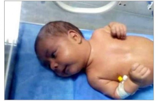 عمره 40 يوماً.. أصغر مصاب بمصر ينتصر على الفيروس
