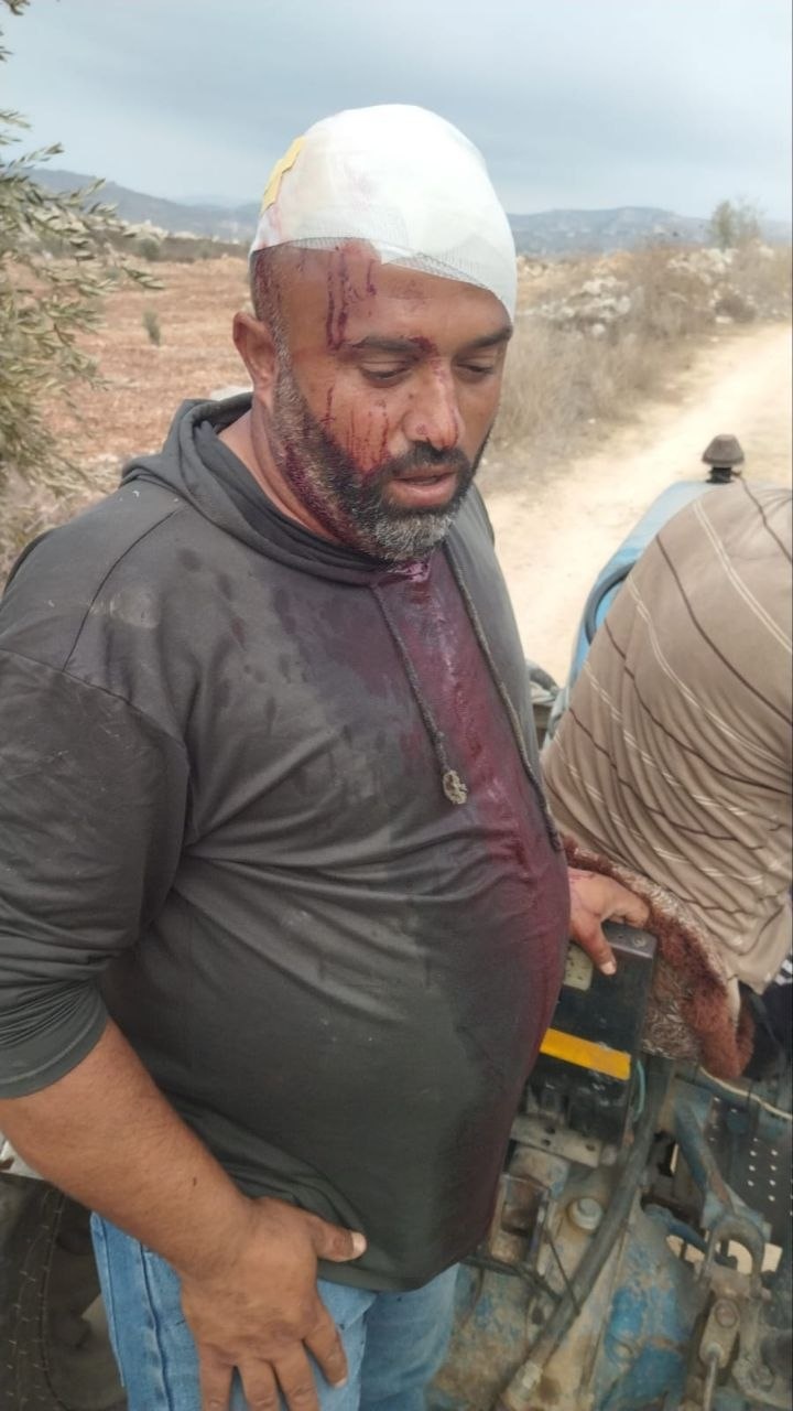 صور...مستعمرون يهاجمون المنطقة الصناعية شرق طولكرم ويضرمون النيران في مركبات ومنشآت زراعية