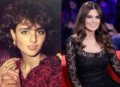 13 مذيعة عربية .. قبل التجميل وبعده