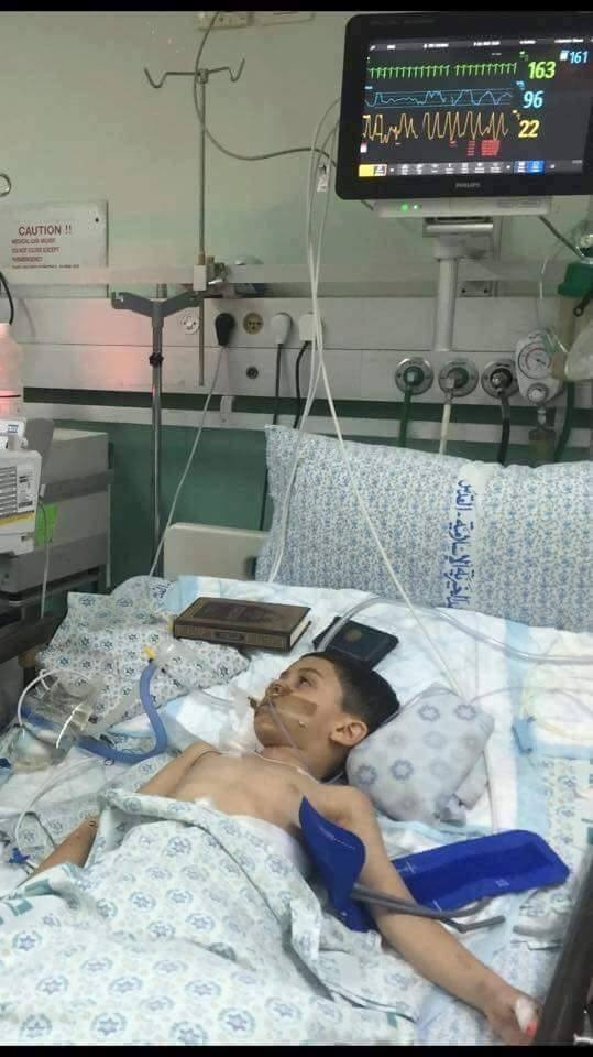 هذه قصة الطفل أمير خضير الذي دخل لإجراء عملية استئصال اللوزتين وخرج بتلف في الدماغ