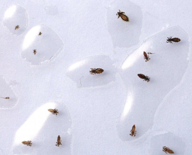 Nitpickin, believed to be the only head lice removal center in Ohio, opened last week in downtown Willoughby, Ohio.  Owner Rick Conroy shows this card to customers who want to know what the head lice look like.  Monday, February 18, 2008  (Chris Stephens/The Plain Dealer)