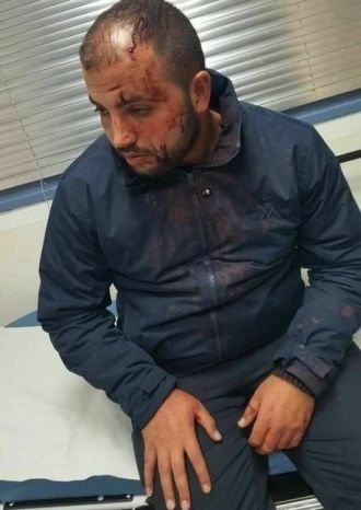 مستوطنون يعتدون بالضرب المبرح على الشاب صلاح ابو جمل