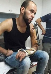 جنود الاحتلال اعتدوا على مصاب خلال اعتقاله