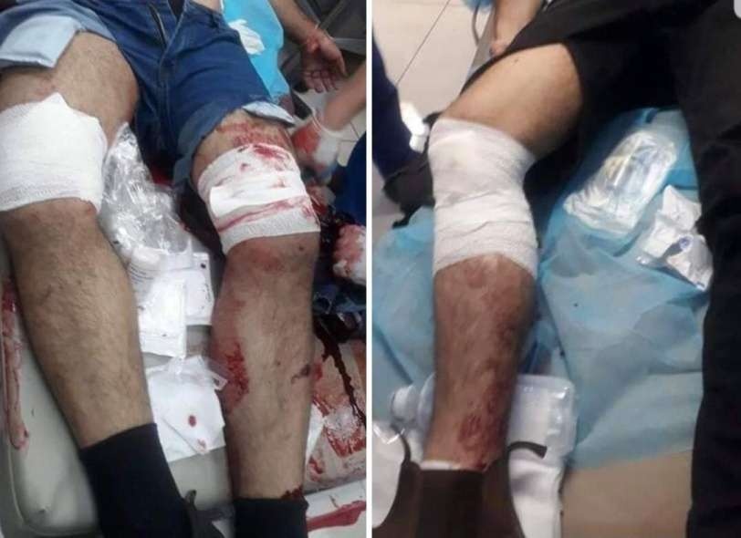 التحقيق بإصابة شاب ورجل أمن في بيت لحم